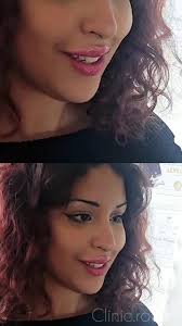 RECEPTIONE al MILANO🇭🇺 31Maggio ,1-8 Giugno, Laregistrazione e aperta a  direct🤗, ✨️Barbie lips👄, 🔥trend 2025🔝, ✨️Russian lips technique, ✨️Lips  natural effect, ✨️Bratz lips, ✨️BotoxFullFace, ...