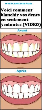 Voici Comment Blanchir Vos Dents En Seulement 3 Minutes Video Lol