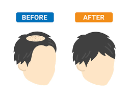 Aga治療」の画像 - 533 件の Stock 写真、ベクターおよびビデオ | Adobe Stock