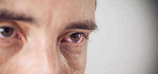 Click on a location to reveal opening times, clinic phone numbers and addresses. Primary Eyecare Provides Nhs Funded Eyecare Services Via Local Opticians