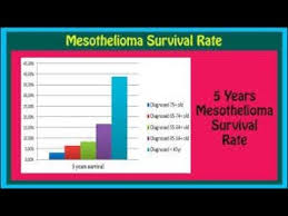 Mesothelioma Survival Rates Give Me My Deals