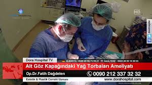 Goz Kapagi Ameliyati Yag Torbalarini Alma Youtube