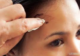 Useful Ideas On How To Remove Hair Dye From Skin Alldaychic Hair Dye Removal Hair Color Remover Dyed Hair