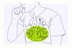 Image result for Lung Cancer