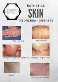 Pin By Carmen Mcneil On Spa Skin Disorders Skin Conditions Pictures Skin Diseases