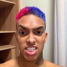 MC Brinquedo conta aos fãs que fez harmonização facial