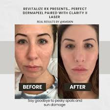 Kerry Macleod (@km_skin) • Instagram photos and videos