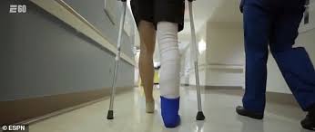Nfl's alex smithdocs put part of my quad into my shin. Redskins Alex Smith Reveals Arduous Comeback Journey From His Gruesome 2018 Leg Fracture Daily Mail Online