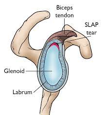Shoulder joint is the most mobile joint of the human body. Slap Tears Orthoinfo Aaos