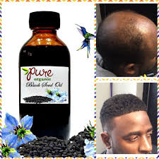 Pin By Allison On Male Hair Growth Serums Black Seed Oil Benefits Hair Remedies For Growth Thick Hair Remedies
