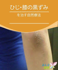 ひじ 膝の黒ずみを治す自然療法ひじ 膝の黒ずみを治す自然療法 黒ずみ 自然療法 スキンケア