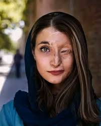 Meet Marzieh, a survivor of an acid attack in Isfahan six years ago.  Despite no justice being served, she's turned her pain into purpose—raising  awareness and pushing for a ban
