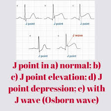 Image result for J Point