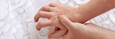 Sweeney, md of the cleveland clinic. Parkinson Frauen Leben Kurzer Als Manner Medical Tribune