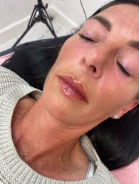 H my facial asthetics clinic in links st Kircaldy is running a competition  free giveaway it's free to enter all u need to do is go to my tik tok  that's under