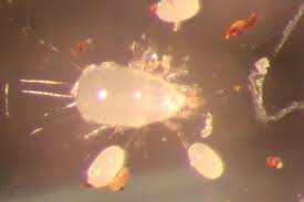 Image result for Gnidia microcephala