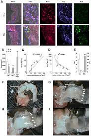 Stephanie graff with beth ferester & company is a real estate professional in the woodlands, tx. Macrophage Plasticity In Experimental Atherosclerosis