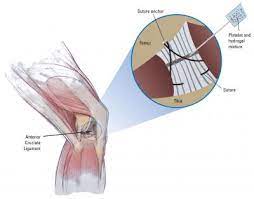 Mit flexionstabellen der verschiedenen fälle und zeiten aussprache und relevante diskussionen kostenloser vokabeltrainer Getting Acl Tears To Heal Themselves Eurekalert Science News