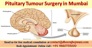 Average Cost Pituitary Tumour Surgery In Mumbai Found Very Reasonable By Medical Tourists Tumor Pituitary Gland Tumor Pituitary Gland