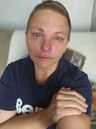 Prayers and healing vibes for chemotherapy nerve pain