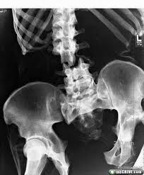 Creepy Radiology Humor Radiology X Ray