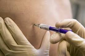 How to stop breakthrough bleeding ( spotting ) on birth? The Contraceptive Injection Nhs