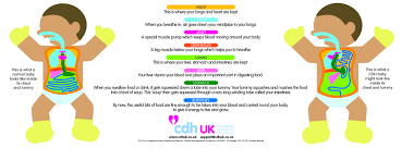 This Is A Child Friendly Illustration To Help Children Understand A Little About The Condition This May Be Useful As An Helping Kids Raise Awareness Awareness