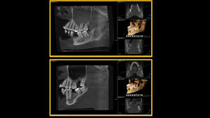1 it is currently under the administration of local council majlis perbandaran kajang (mpkj). Lau Dental Bandar Sg Long Home Facebook