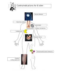 Modality Contraindications Physical Therapy Electrical Stimulation E Stim Physical Therapy Therapy Physical Therapist