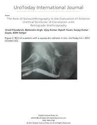 Image result for Retrograde Urethrogram