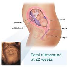 In the gregorian calendar, an average month has exactly 30.436875 days. Fetal Ultrasound 5 Months Babycentre Uk