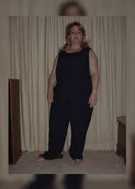 Your doctor can explain the risks and complications most associated with gastric bypass so that you can decide if undergoing surgery is the best decision for. Can Bariatric Surgery Cure More Than Just Obesity Obesity Control Center