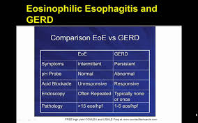 May be viral or fungal. Usmle Eosinophilic Esophagitis