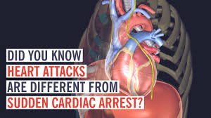 The differences between heart attack and cardiac arrest in terms of symptoms are that during a heart attack a person experience chest pain, shortness of breath, cold sweats, coughing, and wheezing. What Happens In A Heart Attack Vs Cardiac Arrest Youtube