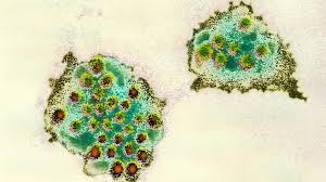 It passes easily through direct or norovirus can also be a source of food poisoning, because you can get it from eating contaminated. About 60 North East Schools Hit By Norovirus Outbreak Bbc News