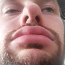 Schusterbergweg Hymne 2021