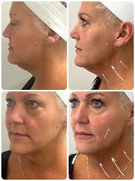 Reviews of Farashe Med & Day Spa