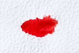 Your next period should start at the expected time, or a few days early/late. Spotting Vs Period Differences And Common Causes