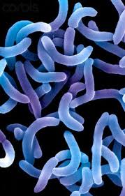 vibrio cholerae bacteria cause cholera in humans 42 23598075 botanica vibrio cholerae bacteria cause cholera