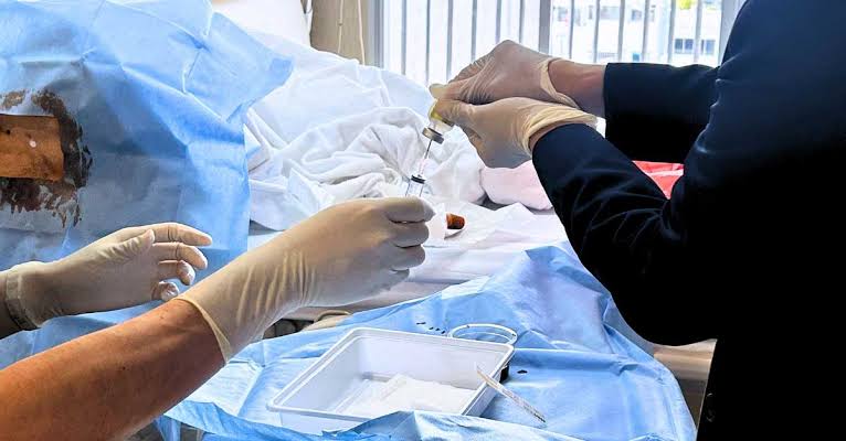 Stem Cell Therapy in ALS Treatment 