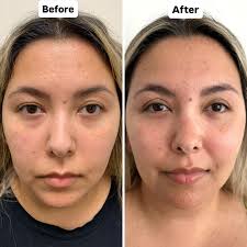 Dr. Babak Maleki, Oculoplastic Surgeon