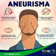 Aneurisma é uma dilatação inusitada (vários fatores podem ocasionar essa dilatação) de um vaso sanguíneo, que fica enfraquecido e pode o indivíduo vir a óbito. Aneurisma Fisaep