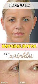 Homemade Natural Botox For Wrinkles Beauty Total Com Natural Botox Botox Wrinkles Anti Aging Face Mask