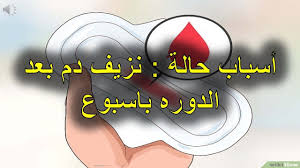 بس اشغله من الصفحه يطلع مافيه مشكلة. Ø£Ø³Ø¨Ø§Ø¨ Ø­Ø§Ù„Ø© Ù†Ø²ÙŠÙ Ø¯Ù… Ø¨Ø¹Ø¯ Ø§Ù„Ø¯ÙˆØ±Ù‡ Ø¨Ø§Ø³Ø¨ÙˆØ¹ Youtube