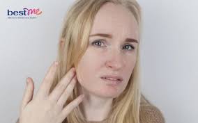 Tại sao bôi kem chống nắng bị vón cục? Cách bôi chuẩn không vón