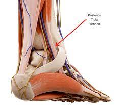 Posterior Tibial Tendonitis Foot And Ankle Specialists Of The Mid Atlantic