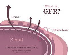 Glomerular filtration filtrate is produced by the glomerulus when the hydrostatic pressure produced by the heart pushes water and solutes through the filtration membrane. Glomerular Filtration Rate Gfr Gaytri Manek Formerly Gandotra Md