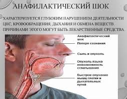Bolit Gorlo Posle Alkogolya Wine Water