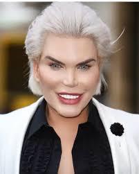 OMG!🤯Known as the "Human Ken Doll", this "man" underwent over $1 million  in surgeries to transition into his true self