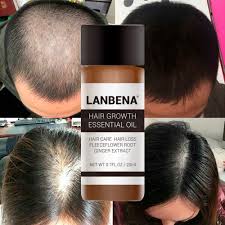 Check out the 5 top hair growth products of 2021 for men & women. Fast Hair Growth Products Best Hair Products For Men Hair Pomade Best Hair Gel For Men Make Your Hair Grow Faster Biotin For Hair Loss Pomade For Men Emporiaz